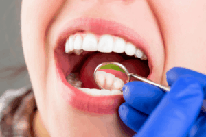 Teeth whitening procedure in progress with a dental check-up, showing clean and bright teeth during professional treatment at a trusted dental clinic for a healthier, whiter smile.